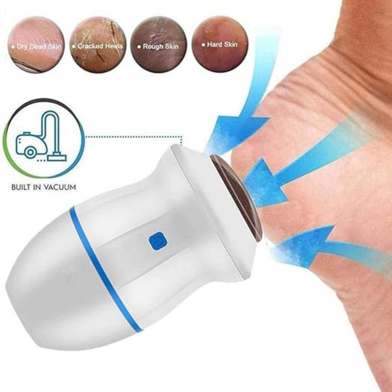 Electric Foot Callus Vacuum Remover USB - Cupindy