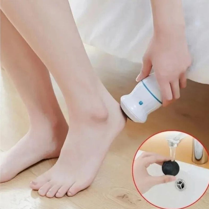 Electric Foot Callus Vacuum Remover USB - Cupindy